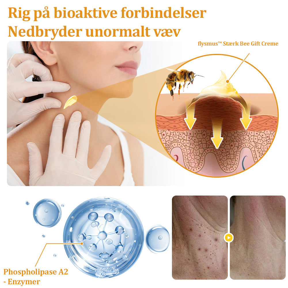 Stærk Bee Gift Creme–Hjælper med at behandle vedvarende vorter, hudvækster, hudlæsioner, infektioner, ardannelse og udglatte ujævn hud👨⚕️