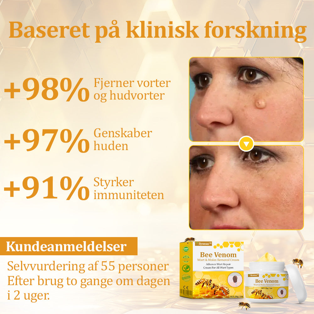 Stærk Bee Gift Creme–Hjælper med at behandle vedvarende vorter, hudvækster, hudlæsioner, infektioner, ardannelse og udglatte ujævn hud👨⚕️