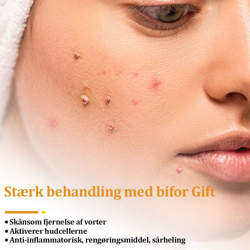 Stærk Bee Gift Creme–Hjælper med at behandle vedvarende vorter, hudvækster, hudlæsioner, infektioner, ardannelse og udglatte ujævn hud👨⚕️