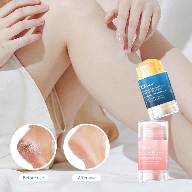 FODFIX INTENSIV - Heleårs Helecreme mod Revnede Hæle