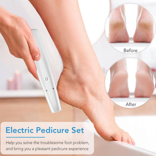 🌸Mor's Day hot sale 75%🌸Elektrisk fod callus fjerner