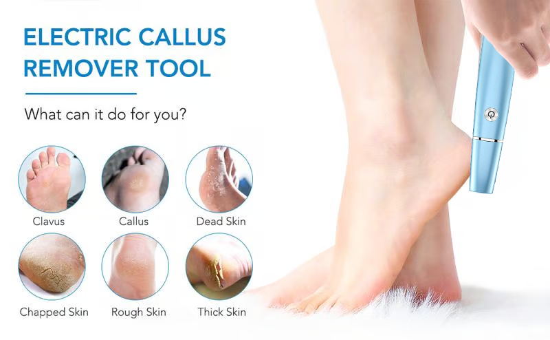 🌸Mor's Day hot sale 75%🌸Elektrisk fod callus fjerner