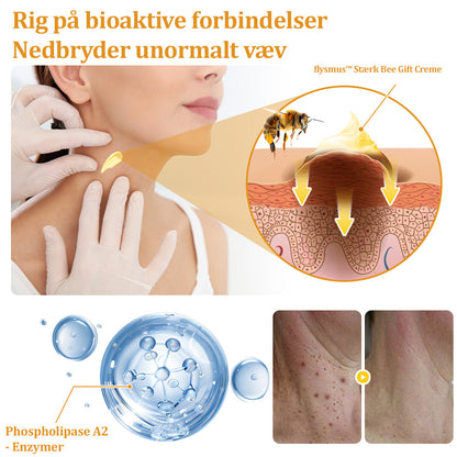 Stærk Bee Gift Creme–Hjælper med at behandle vedvarende vorter, hudvækster, hudlæsioner, infektioner, ardannelse og udglatte ujævn hud👨‍⚕️