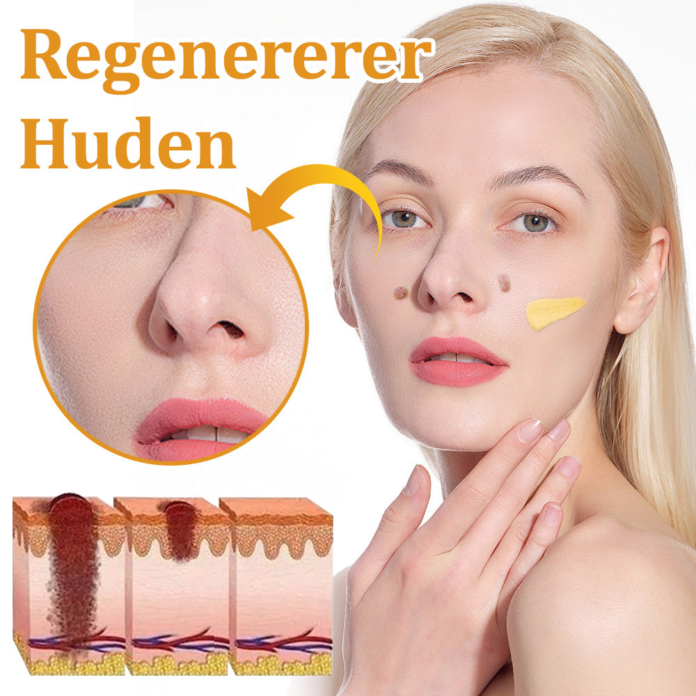 Stærk Bee Gift Creme–Hjælper med at behandle vedvarende vorter, hudvækster, hudlæsioner, infektioner, ardannelse og udglatte ujævn hud👨‍⚕️