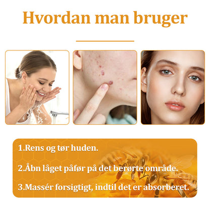 Stærk Bee Gift Creme–Hjælper med at behandle vedvarende vorter, hudvækster, hudlæsioner, infektioner, ardannelse og udglatte ujævn hud👨‍⚕️