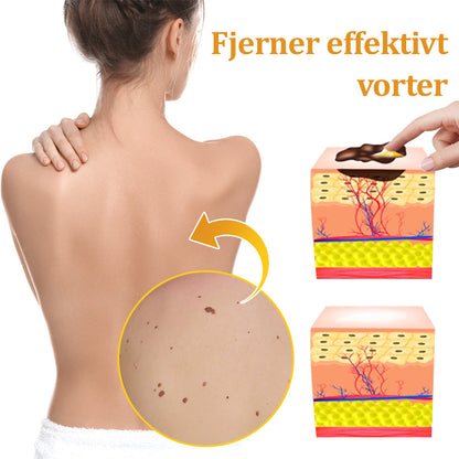 Stærk Bee Gift Creme–Hjælper med at behandle vedvarende vorter, hudvækster, hudlæsioner, infektioner, ardannelse og udglatte ujævn hud👨‍⚕️