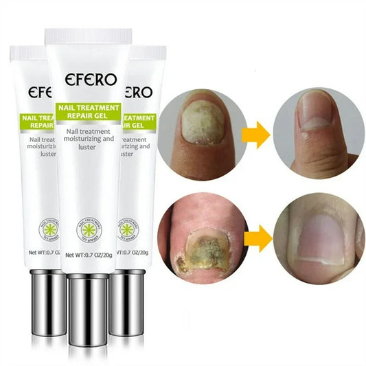 Efero® neglereparationsgel: Smukke negle, uovertruffen selvtilli