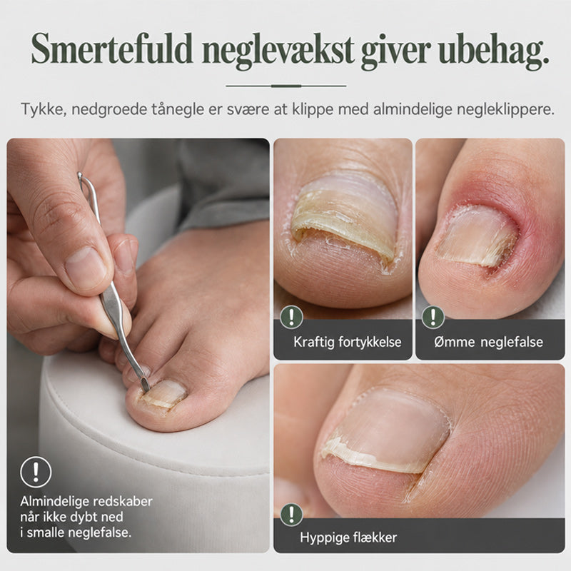📢 50 % RABAT !! ⏰ 2-delt manicuresæt i rustfrit stål: Negleklipper til nedgroede tånegle og tang til fjernelse af død hud