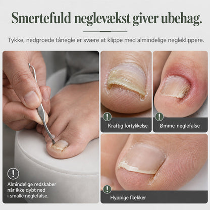 📢 50 % RABAT !! ⏰ 2-delt manicuresæt i rustfrit stål: Negleklipper til nedgroede tånegle og tang til fjernelse af død hud