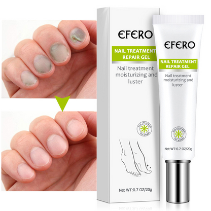 Efero® neglereparationsgel: Smukke negle, uovertruffen selvtilli