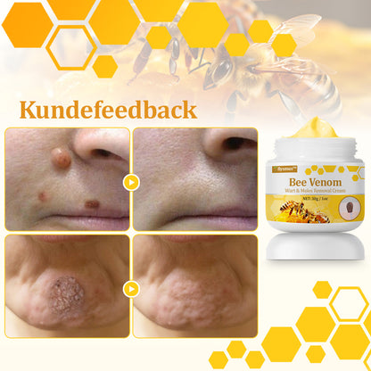 Stærk Bee Gift Creme–Hjælper med at behandle vedvarende vorter, hudvækster, hudlæsioner, infektioner, ardannelse og udglatte ujævn hud👨‍⚕️