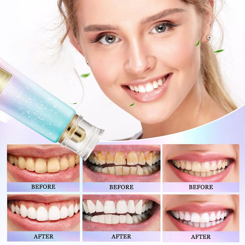 Radiant Whitening-tandpasta