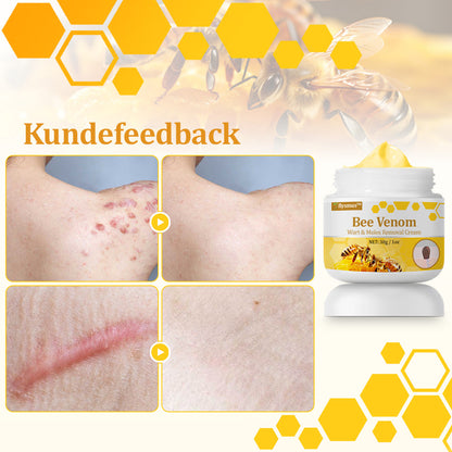 Stærk Bee Gift Creme–Hjælper med at behandle vedvarende vorter, hudvækster, hudlæsioner, infektioner, ardannelse og udglatte ujævn hud👨‍⚕️