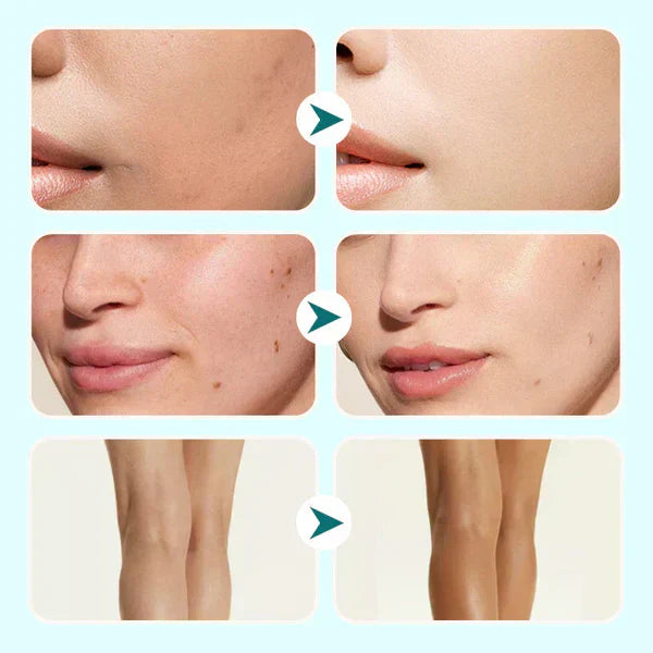 🔥Sidste dag køb 1 få 1 gratis!🎁All-in-one fugtighedscreme, concealer og dækning 💧✨ Let og vandfast