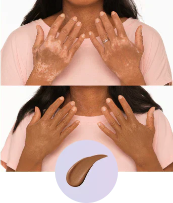 💜Sidste dag – Køb 1, få 1 gratis!💜✨Body Coverage Perfector – vandfast, let og fejlfri kropsmakeup