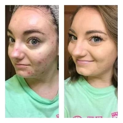 🎉Stort Udsalg med 60% Rabat💝3-i-1 Contouring og Brighten Concealer-Palet